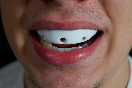 Капа для бокса и ММА